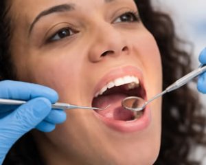 Oral Cancer Screening